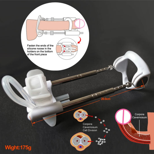 Enlargement and Correction The Ultimate Solution