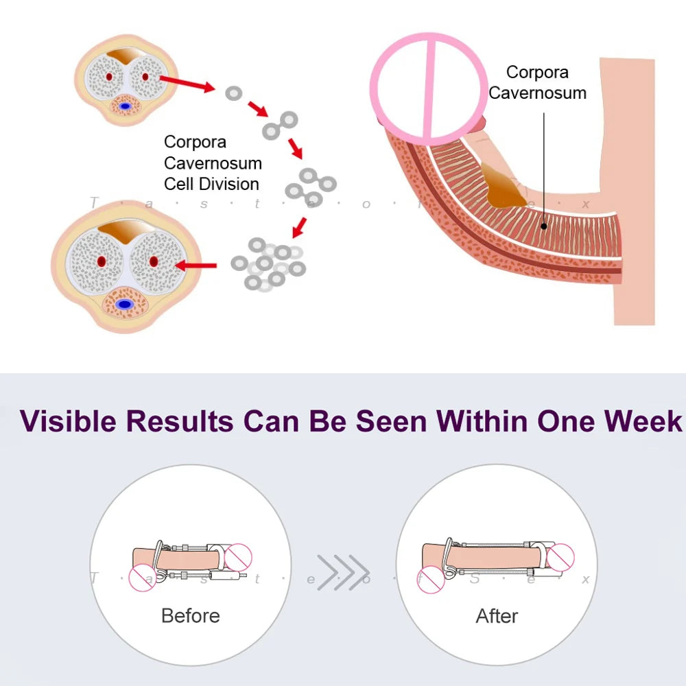 Enlargement and Correction The Ultimate Solution